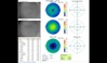 Ocular Imaging - Progression retinal thickness maps showing resolution of fluid following triamcinilone treatment.